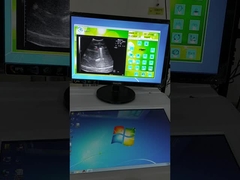 고정파원 외체 충격파 리토트립시 기계 초음파 위치 시스템