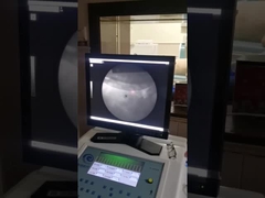 높은 정확성 외체 충격파 기계, 충격 속도 리토립시 엑스레이 시스템