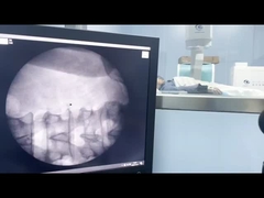 초점 적용 장치와 함께 고주파 외체 충격 파도 기계 1-16Hz 100W